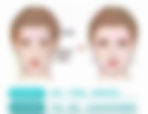 六、沧州市人民医院医专肿 瘤院区(烧伤整形科)怎么预约: