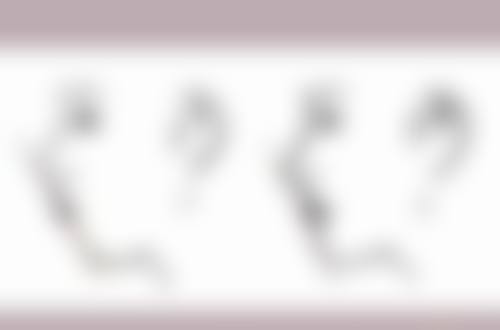 吸脂一个半月还能持续瘦吗？综合来看的优势