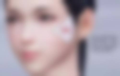 线提升去眼袋成效能维持多久？医生技术也有作用