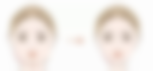 淡红色疤痕变回肉色，药物治疗有妙招