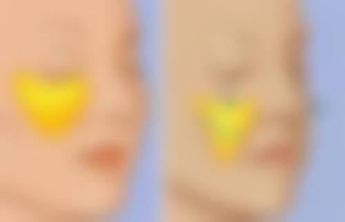 淡红色疤痕如何变回肉色？多维度方法助力，加速淡化让肌肤重焕自然色泽 