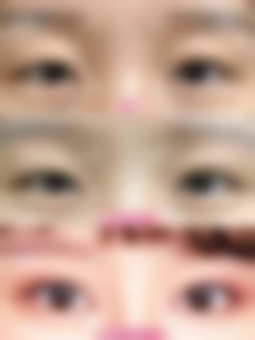 七、襄阳伊尔美医疗美容门诊部价格表：（仅供参考）