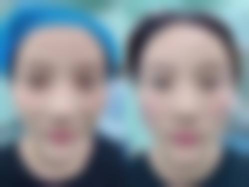 八、济宁睿美整形医院真实的顾客评价如下：