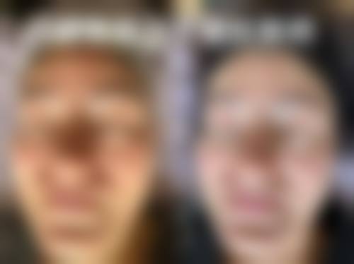 八、延安大学附属医院烧伤整形科真实的顾客评价如下：