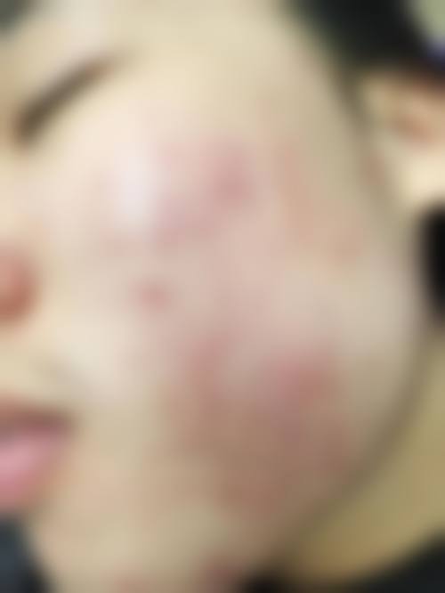 七、任丘名燕医疗美容诊所真实的顾客评价如下：