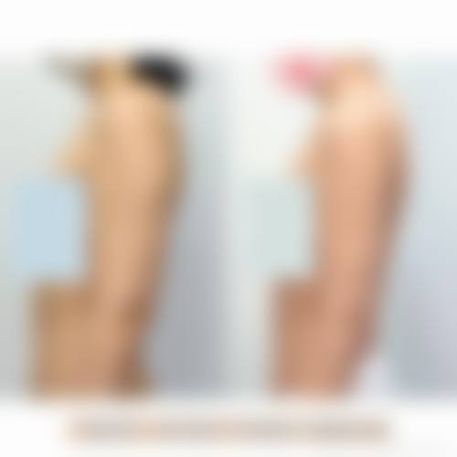 五、济南美莱整形美容医院实例