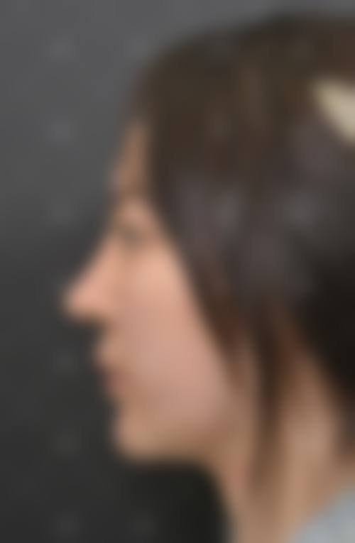 六、郑州那美整形医院价格表：（仅供参考）