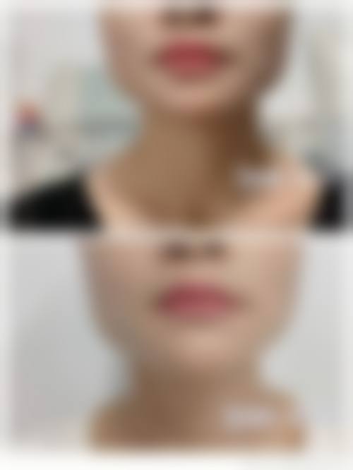 六、永州博美整形美容医院怎么预约：