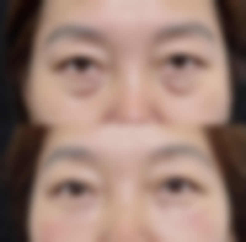 七、济宁睿美整形医院价格表：（仅供参考）