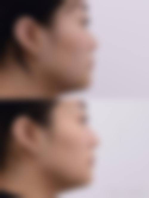 六、广州星面孔医疗美容门诊价格表：（仅供参考）