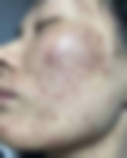 二、济南市皮肤病防治院美容科正规吗？来看看医院资质：