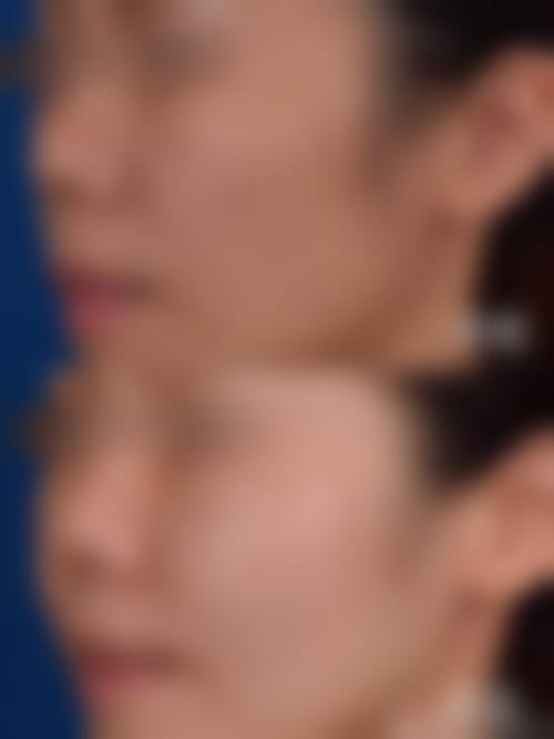 六、蚌埠韩丽医疗美容门诊部怎么预约：