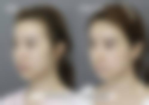 七、广州星面孔医疗美容门诊真实的顾客评价如下：