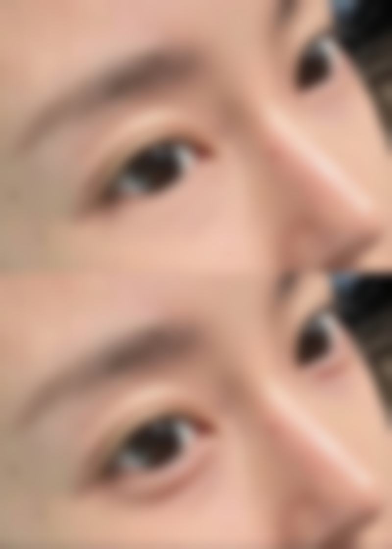 去眼袋眼霜成效咋样？不同类型眼袋见分晓