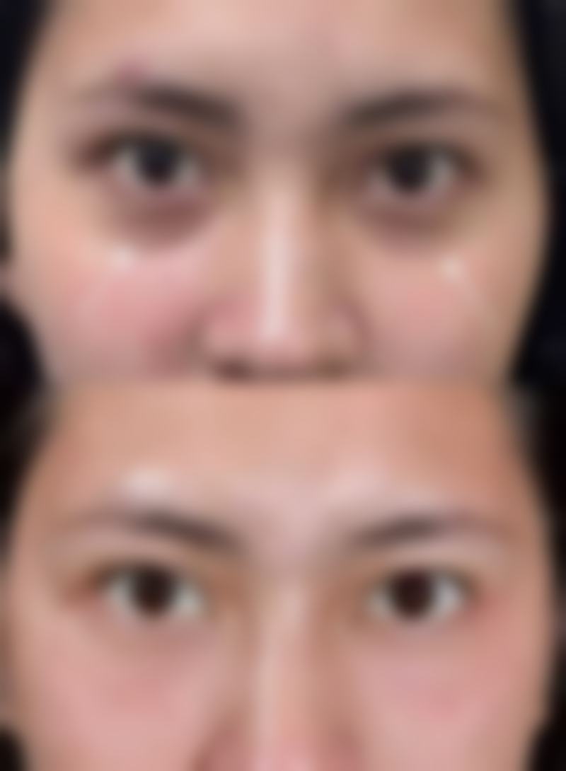 八、青岛市黄岛区中医医院整形美容科真实的顾客评价如下：