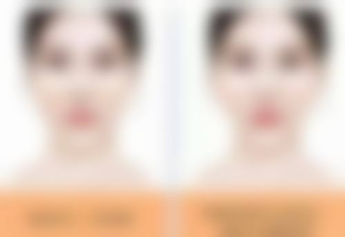 术后护理与敷面膜的关系