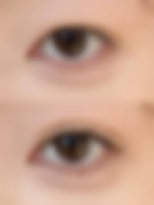 五、西安市邵医生整形美容诊所实例