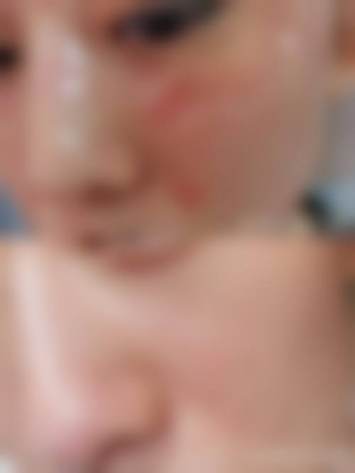 六、吉林大学第二医院皮肤美容中 心怎么预约：