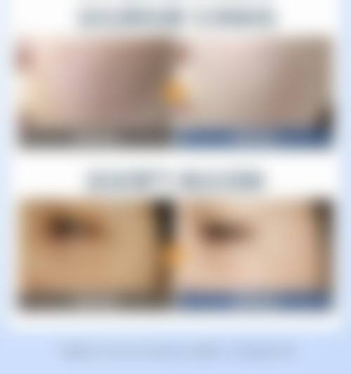 八、吉林大学第二医院皮肤美容中 心真实的顾客评价如下：