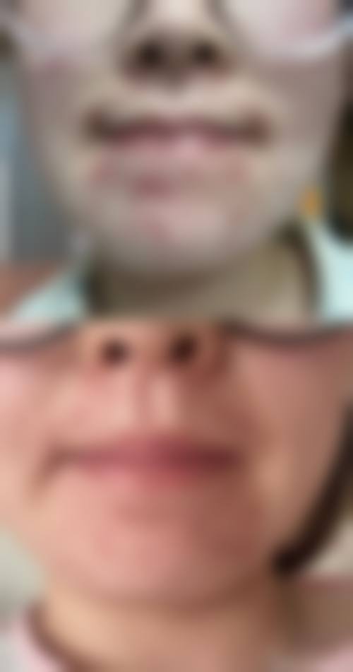 七、吉林大学第二医院皮肤美容中 心价格表：（仅供参考）