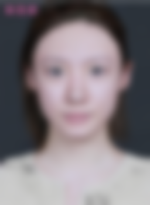 北京米兰柏羽丽都医疗美容医院辛娟的预约方式