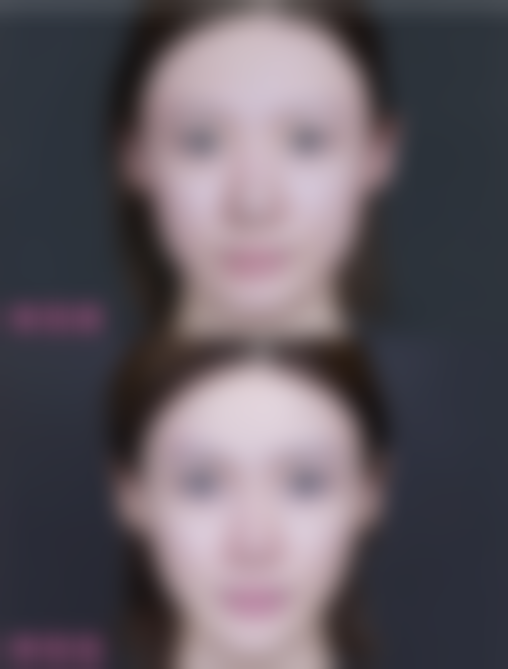 北京米兰柏羽丽都医疗美容医院冯雪燕医生预约方式之到院预约