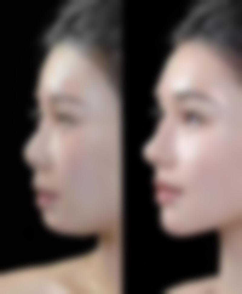 五、带广SkinClinic怎么预约