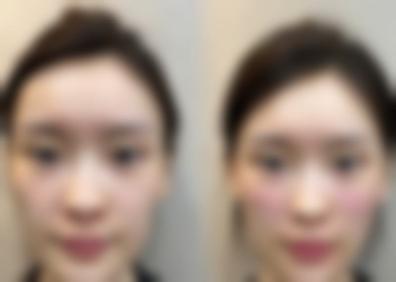 八、北京美易美时代医美诊所真实的顾客评价如下: