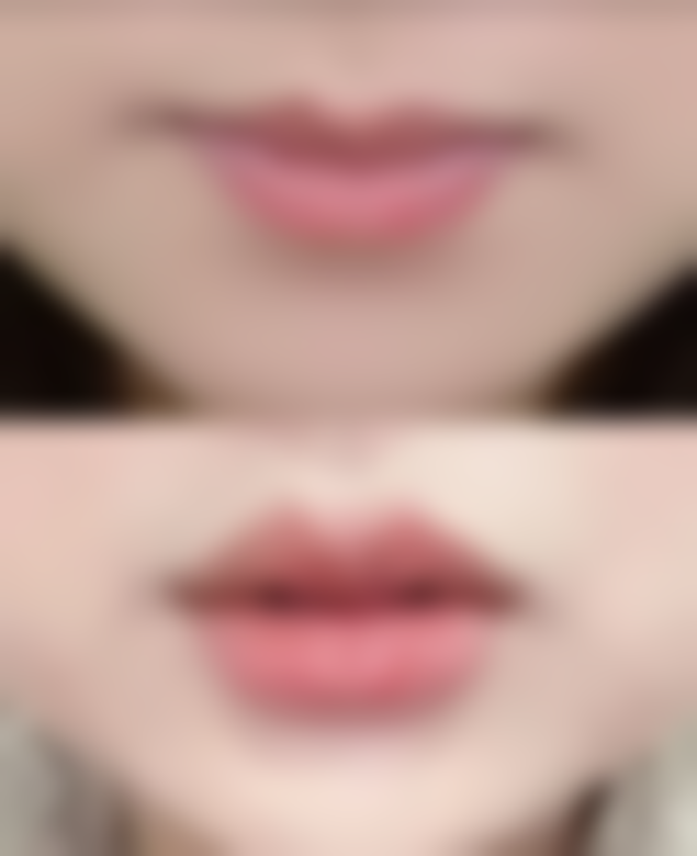 五、东营雅美汇医疗美容诊所怎么预约: