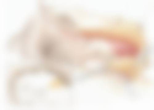 260cc假体隆胸:选择的优势与建议