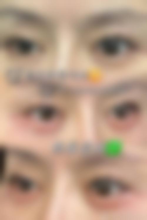 五、東京中央美容外科 TCB 中野院实例