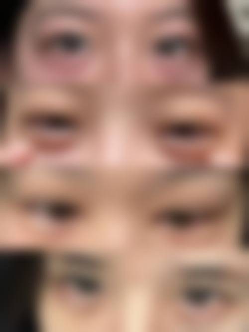 八、東京中央美容外科 TCB 中野院真实的顾客评价如下：