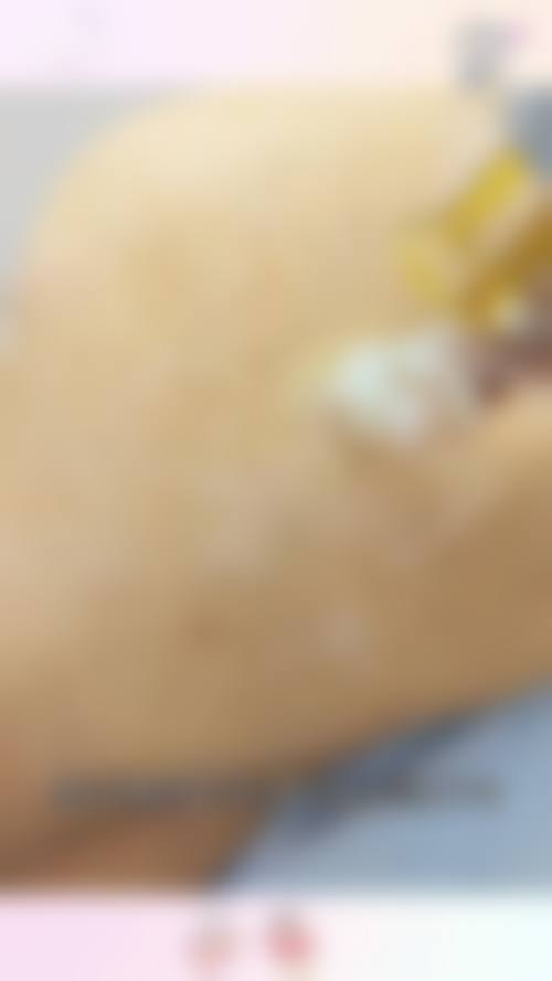 六、上海万众医院整形科价格表：（仅供参考）