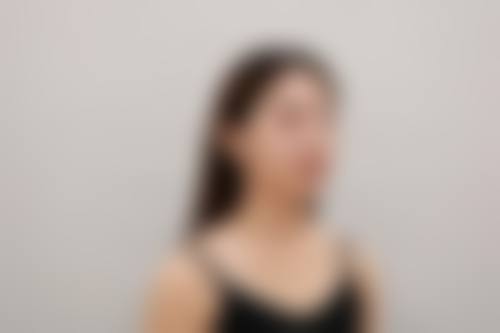 七、Rize Clinic 千叶价格表：（仅供参考）