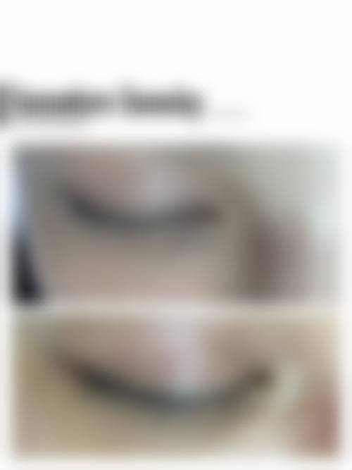 五、成都美壹典零零壹医疗美容门诊部实例