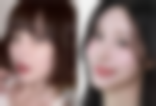 五、大连李鲁阳整形美容医院实例