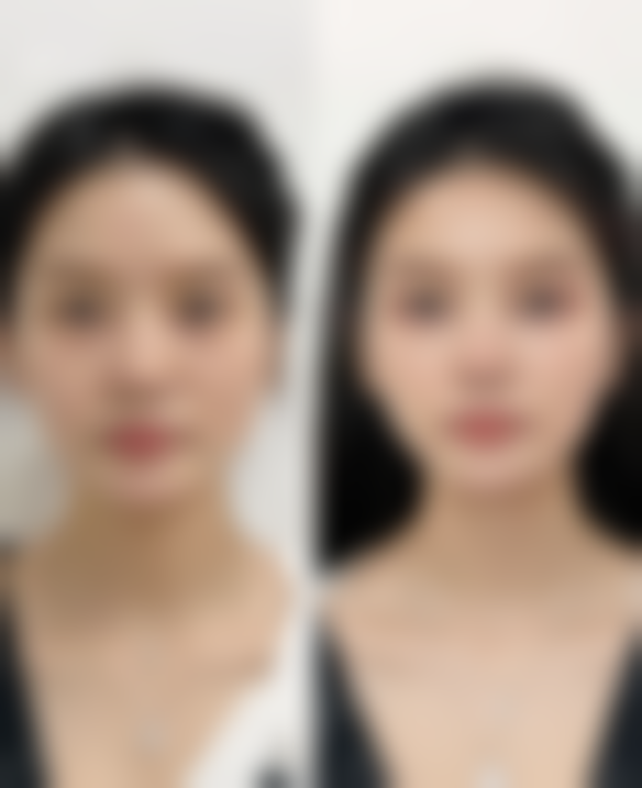 金眼霜去眼袋，改善血循环，一周眼周能收紧？