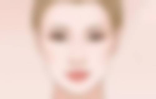 全切双眼皮留疤别忧,特色技术助力美眼梦