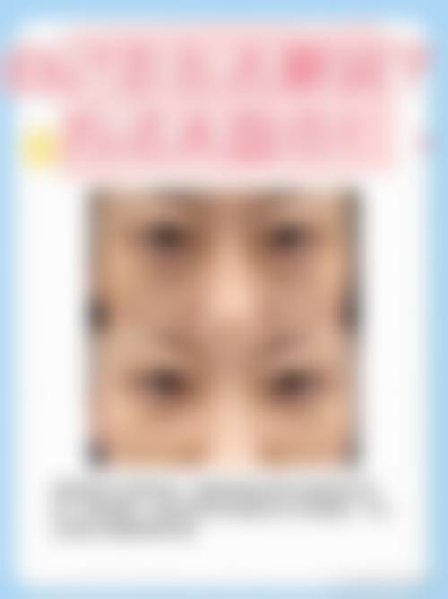 五、石家庄云笙整形医院实例