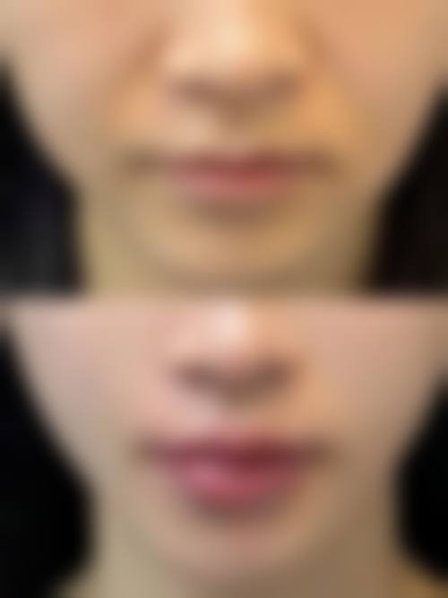 六、石家庄云笙整形医院怎么预约：