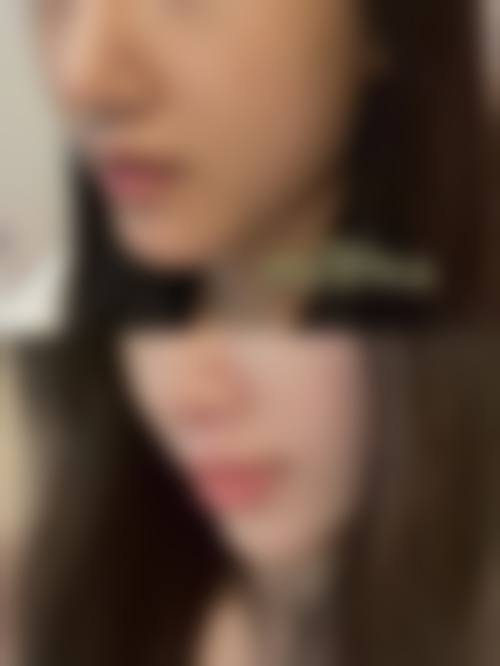 八、珠海璞梵医疗美容诊所真实的顾客评价如下：