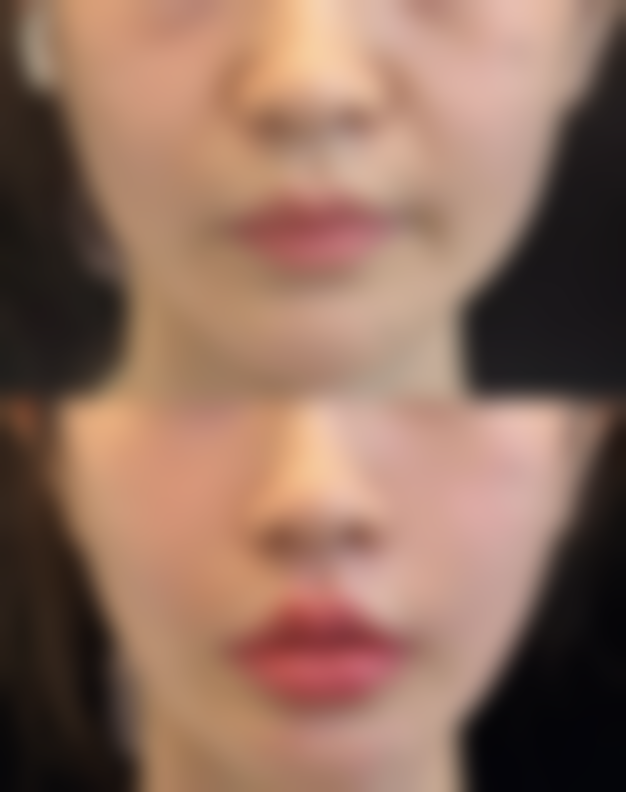 八、深圳美南华黄崇熙医疗美容医院真实的顾客评价如下：