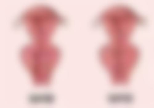 面部抽脂副作用大盘点：肿胀淤青、皮肤凹凸不平如何应对与预防？ 