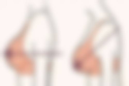 林若兰医生实例