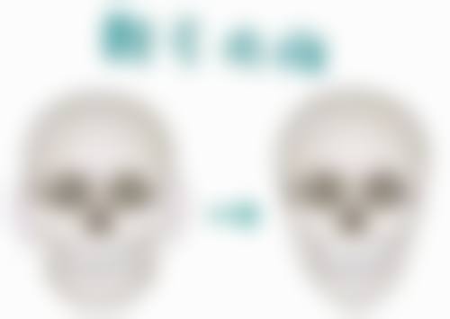 想消除眼袋鱼尾纹？医美治疗显神通