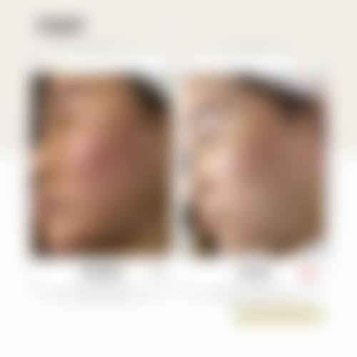 四、广州市花都区人民医院（激光美容科）基本信息：