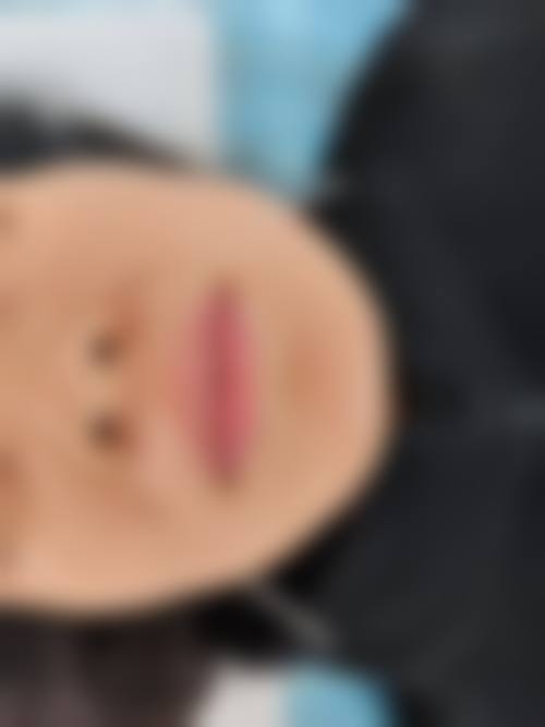 三、广州市花都区人民医院（激光美容科）医生介绍: