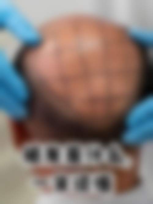 刘野医生项目价格表参考