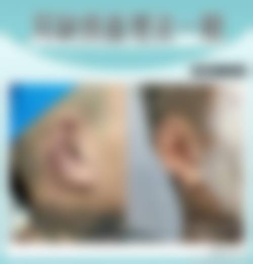 六、泉州康桥优年医疗美容诊所怎么预约：