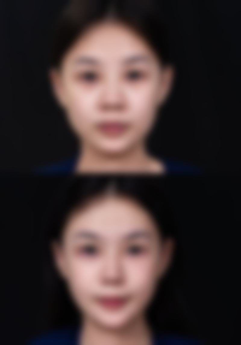 六、天门白年医疗美容门诊部(原江岳)价格表:(仅供参考)